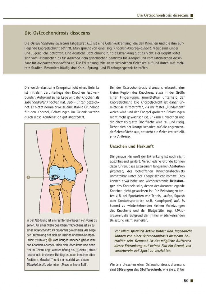 Die Osteochondrosis dissecans