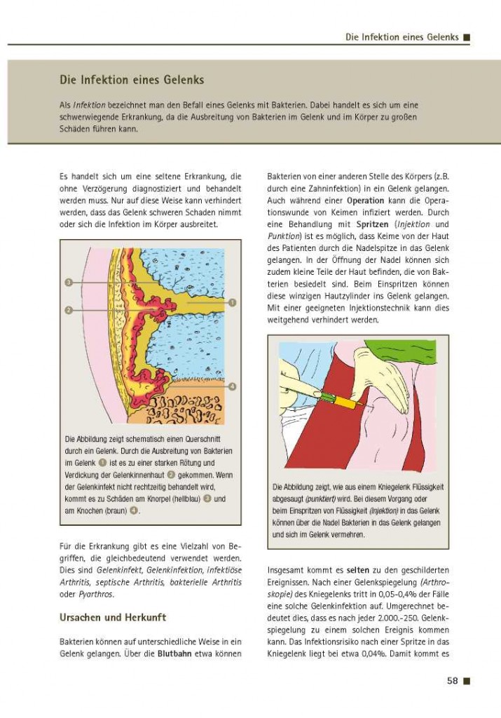 Die Infektion eines Gelenks