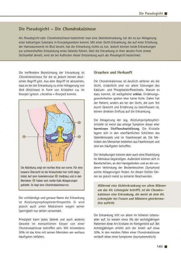 Die Pseudogicht – Die Chondrokalzinose