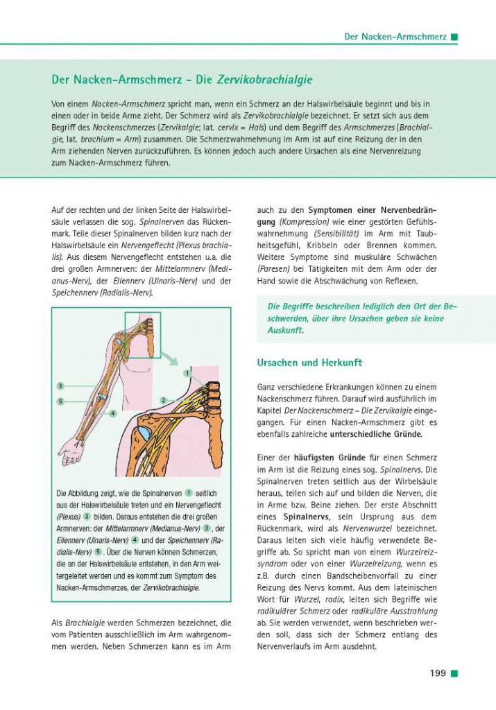 Der Nacken-Armschmerz – Die Zervikobrachialgie