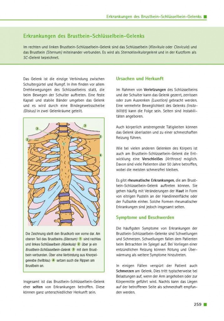 Erkrankungen des Brustbein-Schlüsselbein-Gelenks