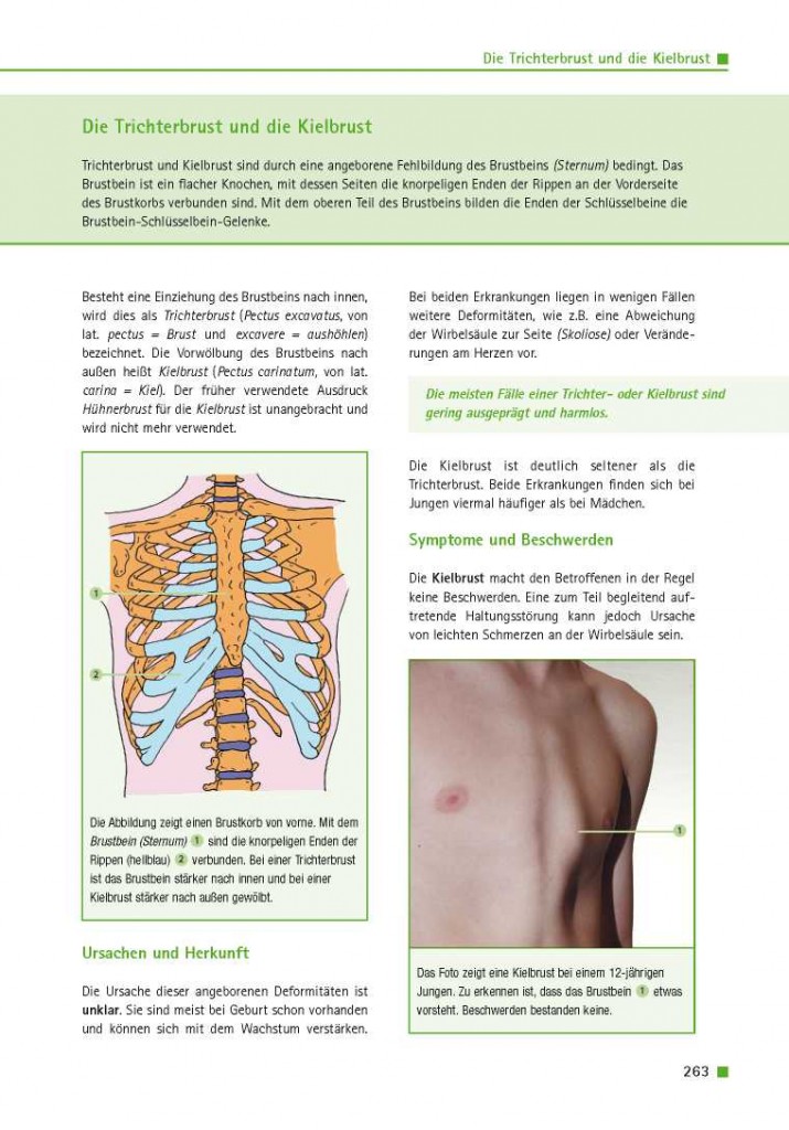 Die Trichterbrust und die Kielbrust