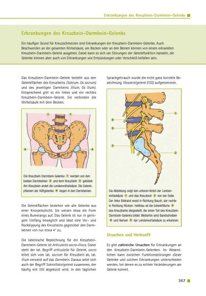 Erkrankungen des Kreuzbein-Darmbein-Gelenks