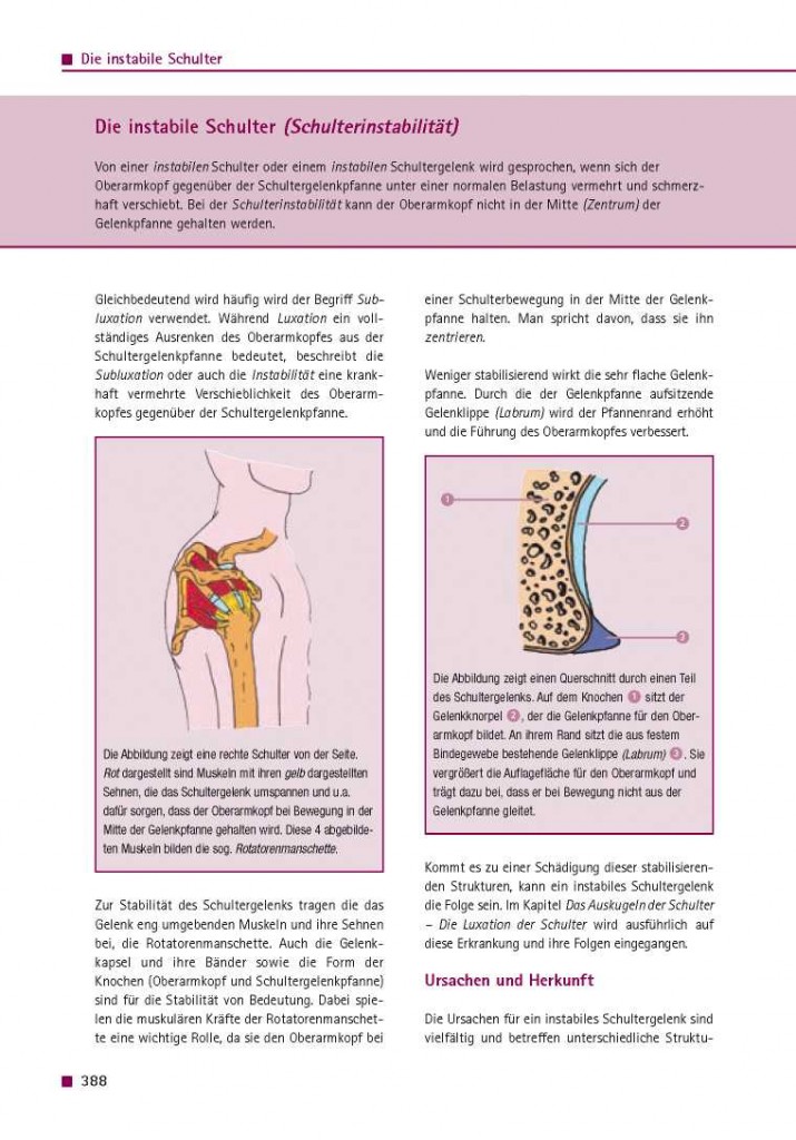 Die instabile Schulter (Schulterinstabilität)