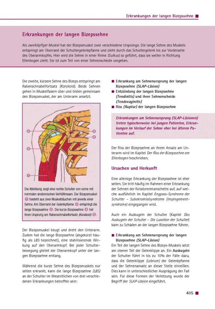 Erkrankungen der langen Bizepssehne