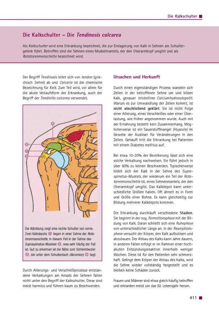 Die Kalkschulter – Die Tendinosis calcarea