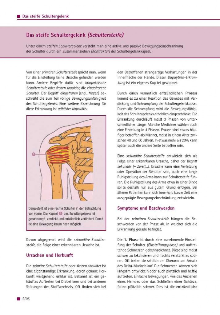 Das steife Schultergelenk (Schultersteife)