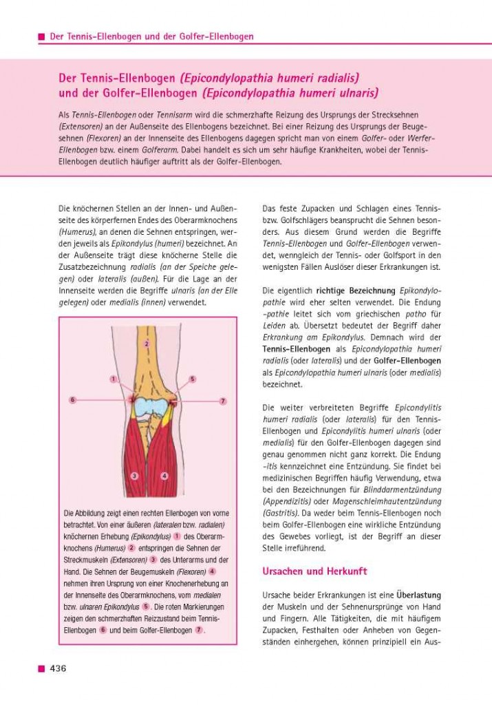 Der Tennis-Ellenbogen (Epicondylopathia humeri radialis) und der Golfer-Ellenbogen (Epocondylopathia humeri ulnaris)
