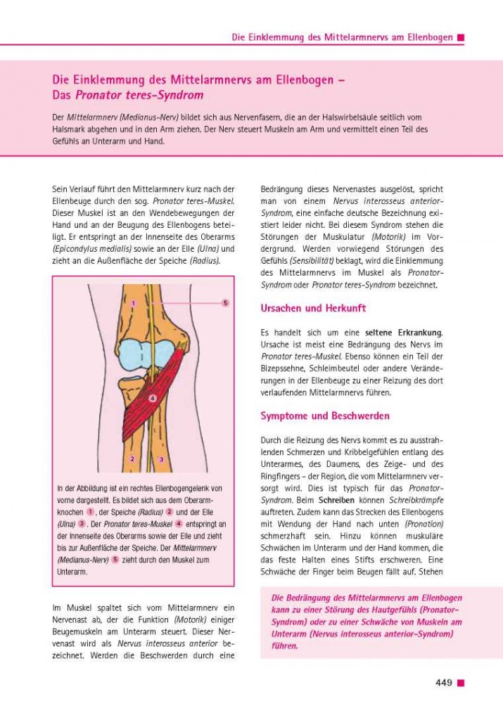 Die Einklemmung des Mittelarmnervs am Ellenbogen- Das Pronator teres-Syndrom
