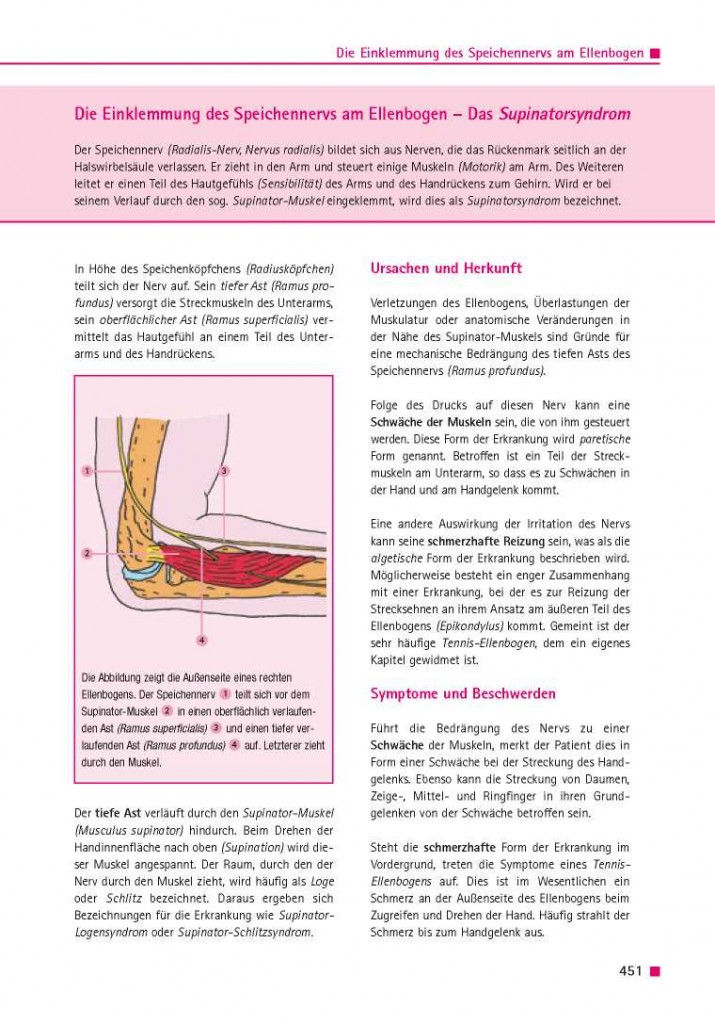 Die Einklemmung des Speichennervs am Ellenbogen – Das Supinatorsyndrom