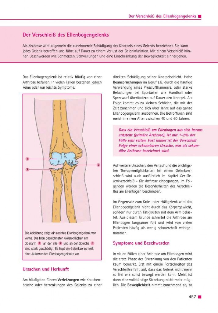 Der Verschleiß des Ellenbogengelenks