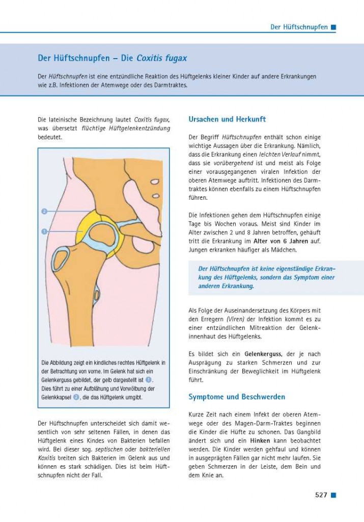 Der Hüftschnupfen – Die Coxitis fugax