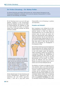 Die Perthes-Erkrankung – Der Morbus Perthes