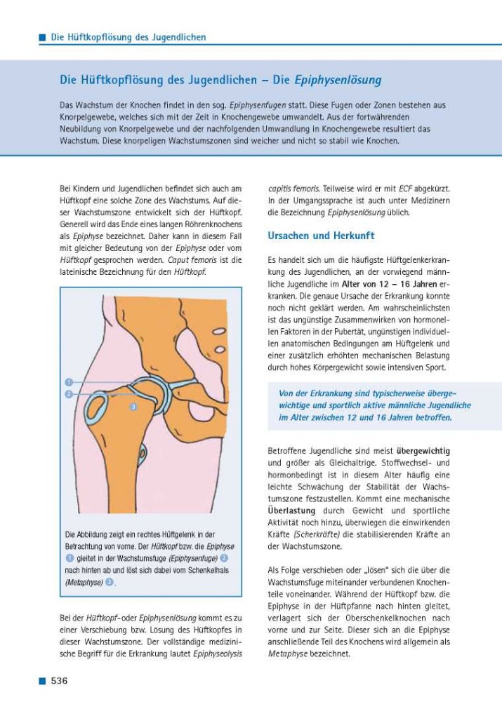 Die Hüftkopflösung des Jugendlichen – Die Epiphysenlösung