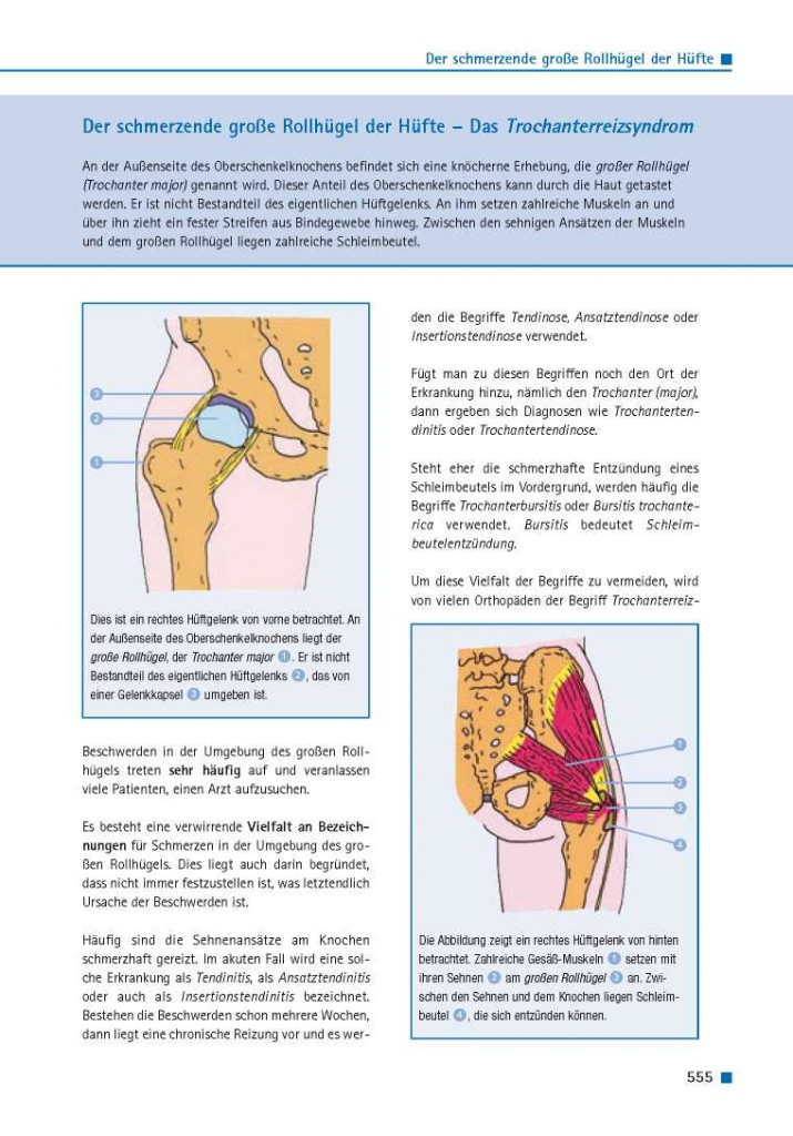 Der schmerzende große Rollhügel der Hüfte – Das Trochanterreizsyndrom