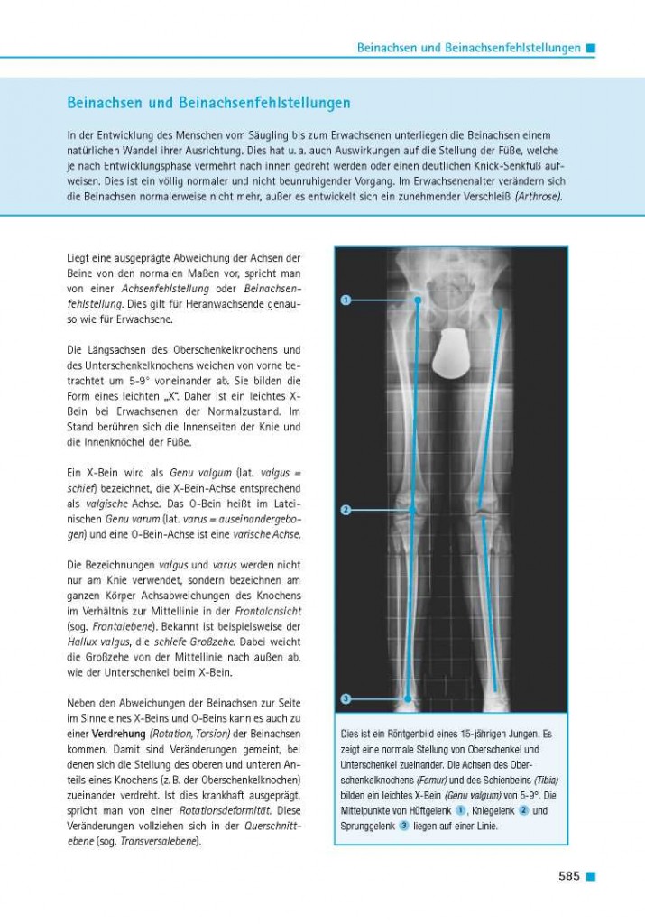 Beinachsen und Beinachsenfehlstellungen