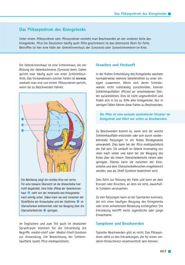 Das Plikasyndrom des Kniegelenks