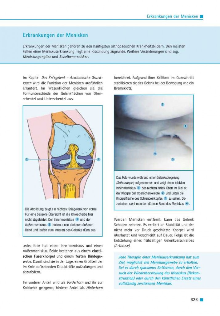 Erkrankungen der Menisken