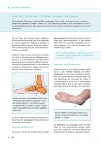 Zusätzliche Fußknochen – Os tibiale externum – Os trigonum
