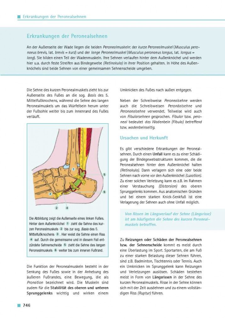 Erkrankungen der Peronealsehnen