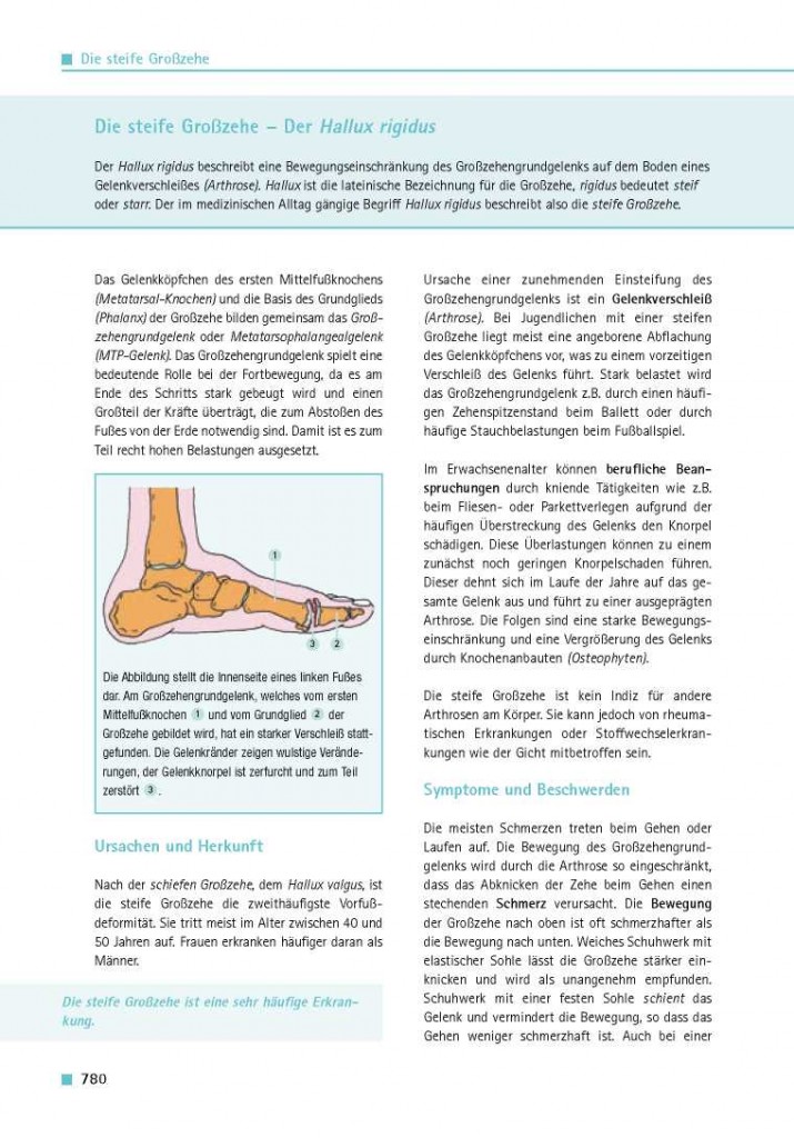 Die steife Großzehe – Der Hallux rigidus